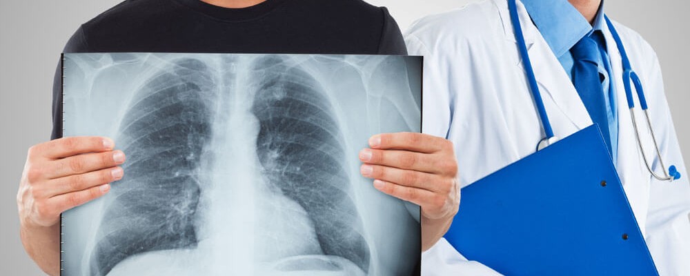 Рентгенодиагностика органов дыхания, средостения и сердечно-сосудистой системы (2 модуль)
