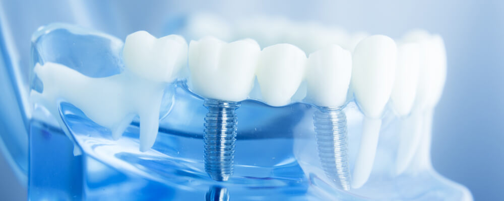 Актуальные вопросы зубного протезирования. Бюгельное кламмерное протезирование (ортопедические и зуботехнические этапы)