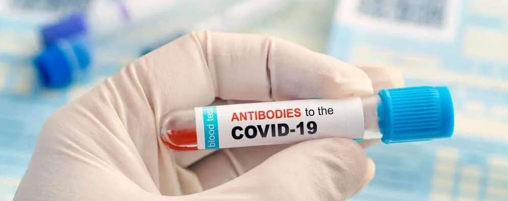 Роль и особенности проведения ЭКМО при лечении пациентов с коронавирусной инфекцией COVID-19